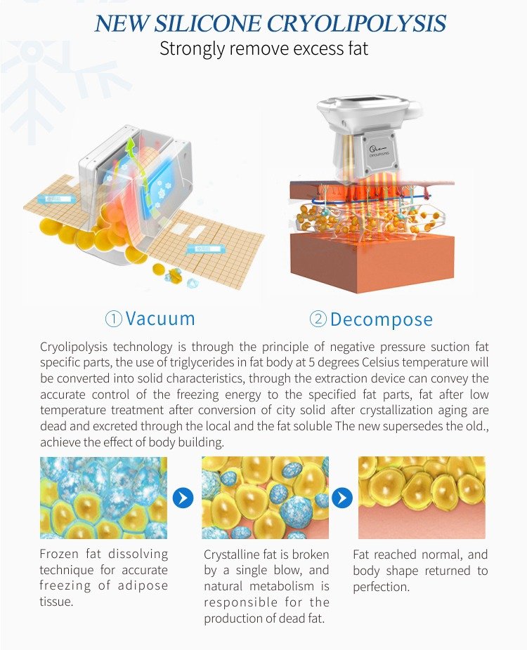 Aparat MultiCryo Sculpt 4X Pro – Criolipoliză, Cavitație 40KHz, Radiofrecvență 5MHz & LipoLaser 6 Paduri - imagine 8