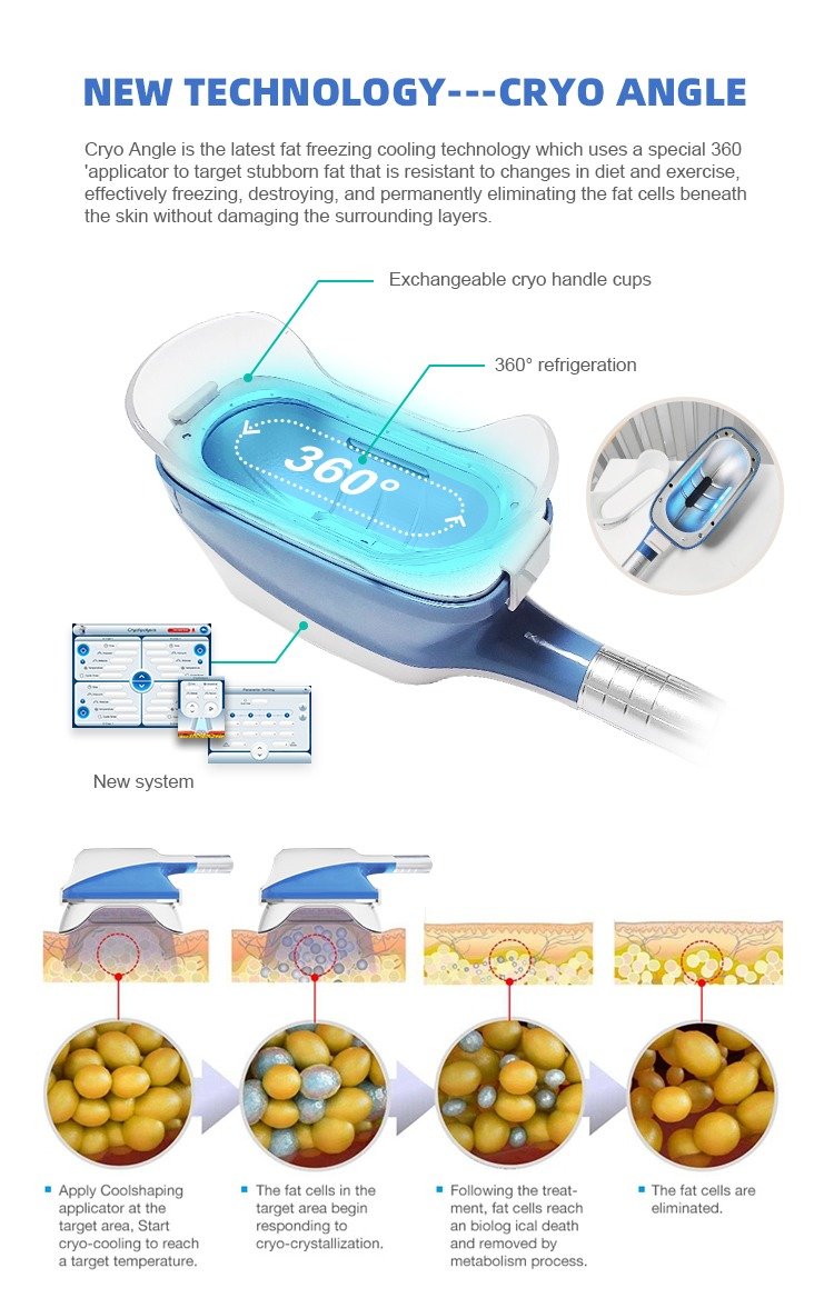 CryoShape Pro 360 Ultimate – APARAT Profesional 5 în 1 pentru Criolipoliză 360°, Cavitație, Radiofrecvență și Lipolaser - imagine 3