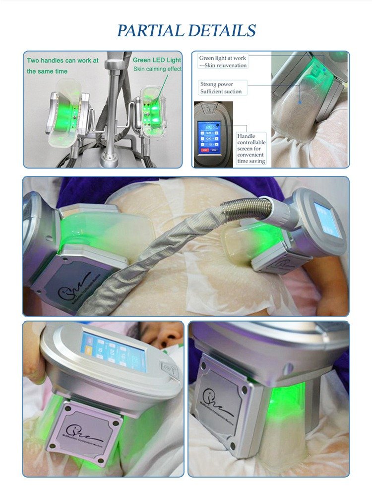 Aparat MultiCryo Sculpt 4X Pro – Criolipoliză, Cavitație 40KHz, Radiofrecvență 5MHz & LipoLaser 6 Paduri - imagine 5