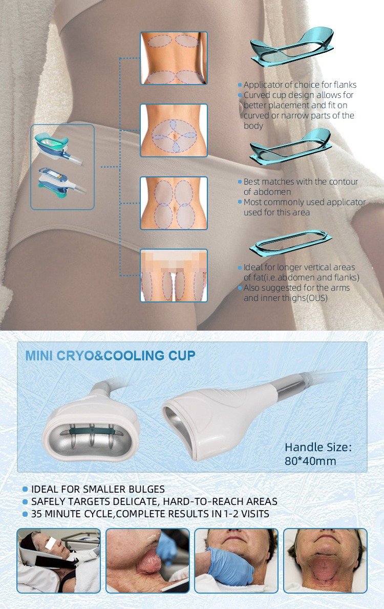 CryoShape Pro 360 Ultimate – APARAT Profesional 5 în 1 pentru ...